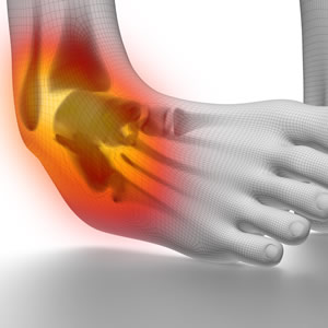 men-common-injuries