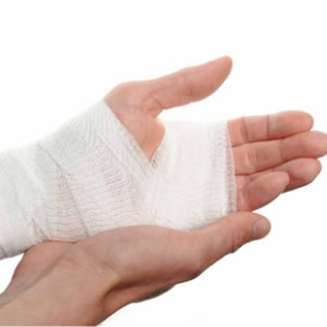 Lacerations